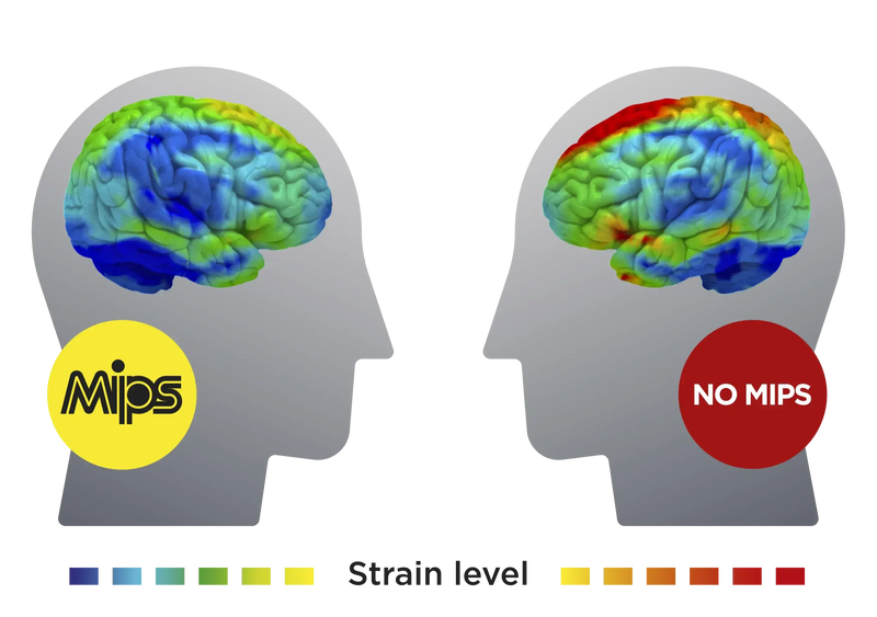 What is MIPS helmet technology?